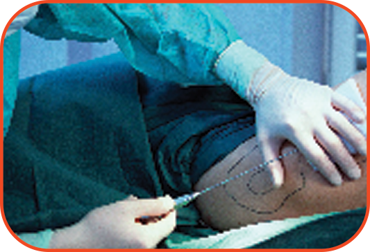 Procedure 1