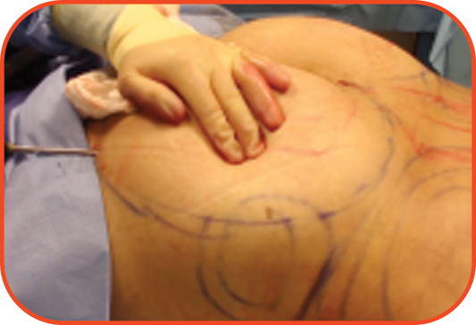 Procedure 2