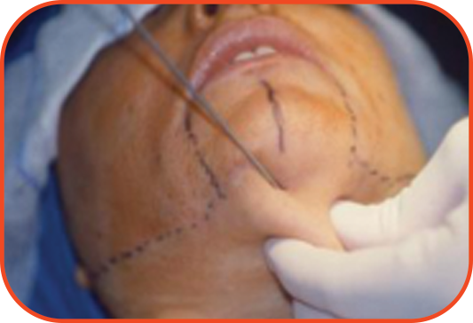 Procedure 5